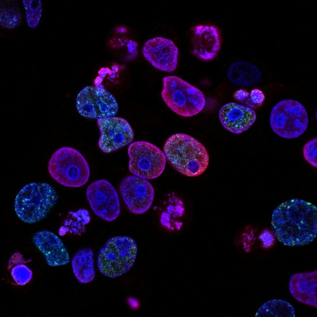 Microscopic cellular view of gut enteroendocrine L-cells synthesizing GLP-1 and peptide YY incretin granules