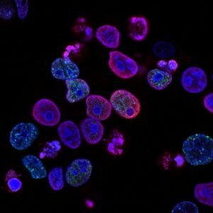 Microscopic cellular view of gut enteroendocrine L-cells synthesizing GLP-1 and peptide YY incretin granules