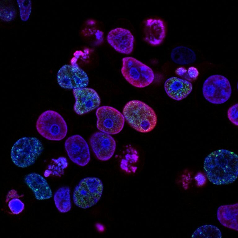 Microscopic cellular view of gut enteroendocrine L-cells synthesizing GLP-1 and peptide YY incretin granules